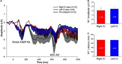 The Effect of Side of Implantation on the Cortical Processing of Frequency Changes in Adult Cochlear Implant Users